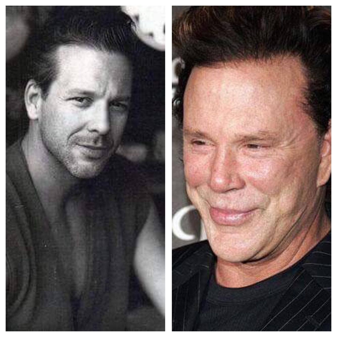 Celebrități masculine distruse de operațiile estetice