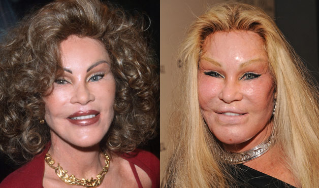 54eab143af0f8_-_03-botch-plastic-surgeries-jocelyn-wildenstein-lifestyle-1