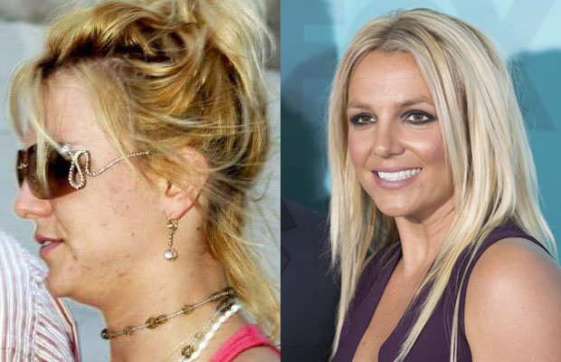 Britney-Spears-Without-Makeup
